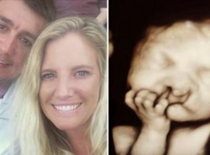 Szülei megtagadják a “deformált” baba elvetetését – csak nézd meg őt most, 2 évvel később