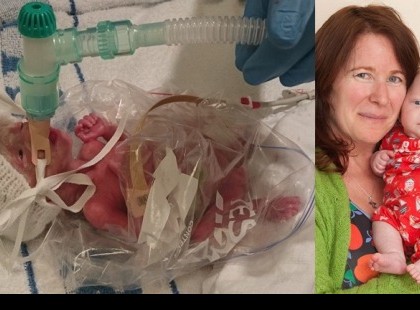 A kislány fél kilogrammos testsúllyal született, és biztosnak tűnt, hogy meghal. Ekkor az orvos minden habozás nélkül egy váratlan döntést hozott: