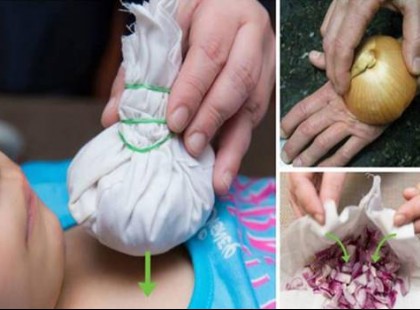 9 betegség, amelyekre a hagyma a legkiválóbb házi gyógyír