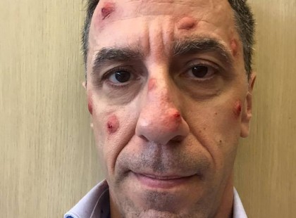 Csonka András kiakadt, 4 kiflit és egy csomag sonkát vett 3200 forintért..