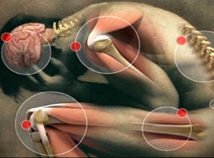 A B12-vitamin hiány egyáltalán nem játék! Ez a 10 legbiztosabb jele!
