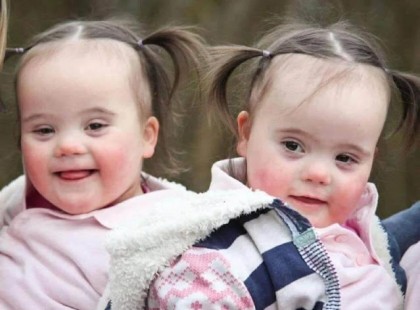 A világért sem változtatnék a lányaimon – mondja az anyuka, akinek Down-szindrómás ikrei születtek
