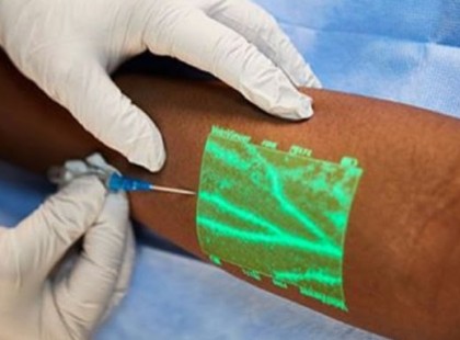 Az új találmány, ami megmutatja hol van a véna..Nincs többé mellé szurkálás, itt van, hogy működik