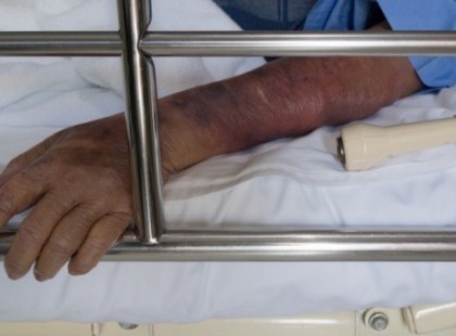 Egy nagyon szomorú hírt kell megosztanom,a héten szerdán Mamámmal leutaztunk Debrecenbe a Kenézy Gyula Kórházba mivel a Mikepércsi otthonban elő dédim kiszáradt!