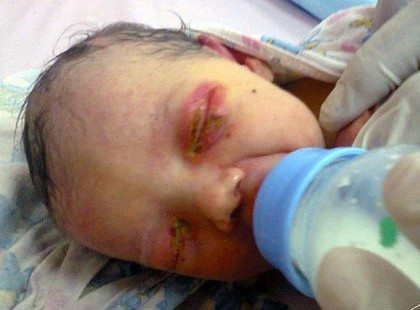 Tegnap egy három napos csecsemőt találtak az erdőben! Hangyák marták a pici testét, de túlélte a három napot az erdőben az újszülött! Megrázó képek következnek!