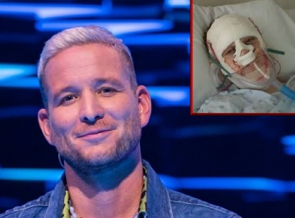 Hatalmas verést kapott Istenes Bence! Istenes Bencét úgy elverték, hogy alig lát ki a fejére nőtt duzzanattól