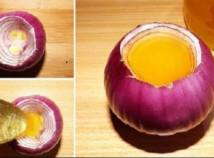 A nagymama köhögés elleni szirupja ami azonnal hat!