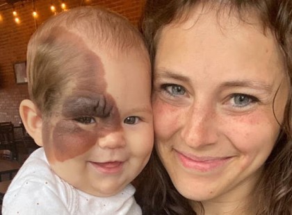 Sokan bántják a kislányom amiért ilyen az arca, kérlek titeket olvassátok el EZT mielőtt ítélkeznétek!