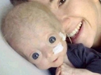 Koraszülött babámnak nem sok esélyt adtak az orvosok a túlélésre..de nézzék csak meg 5 évvel később