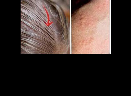 A pajzsmirigyprobléma 11 rejtett jele, amiről szinte senki sem vesz tudomást!