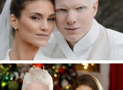 A legjóképűbb albínó modell megmutatta a kisfiát, azonnal felrobbant a net! Leendő szupermodell a gyerek!