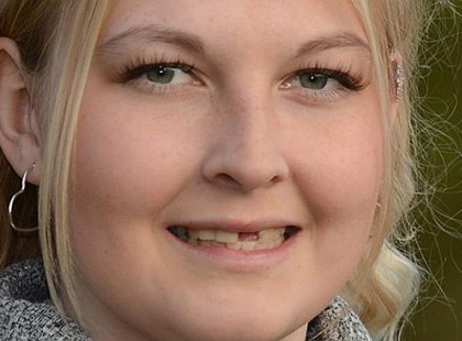 Kihullott az összes fogam az orvosok miatt!Elmesélem a történetem .Olyat tett ez az orvos ,amit meg kell tudjanak a felettesei! Tessék tovább adni