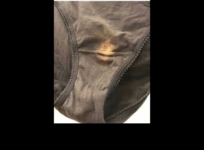 Ha találsz egy „fehérítő” foltot az alsóneműdön, jobb, ha tudod, mit jelent ? Fogalmam sem volt róla...