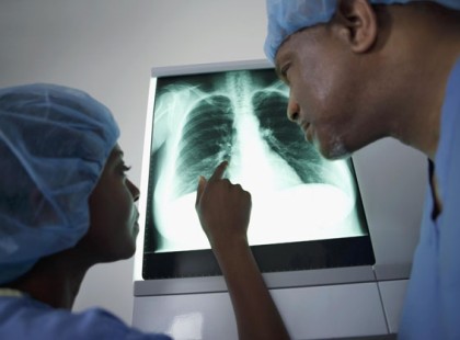 Egyre több a daganatos fiatal nő: ez az oka a szakértő szerint