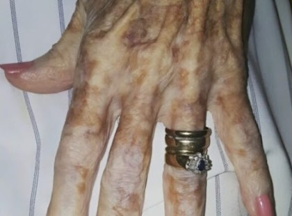 A nővér lefotózta egy idős nő kezét, és közzétette az interneten. ? Senki sem vett észre semmi különöset, amíg el nem olvasták a nővér magyarázatát. ? Te sem vettél észre semmit? Itt van a magyarázat ⬇️⬇️