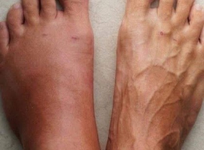 ? Egy hónappal a szívroham előtt a tested a következő 10 jelre figyelmeztet! Ne hagyd figyelmen kívül! ?