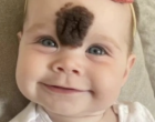 A kislány homlokán hatalmas anyajeggyel született – a szülei merész döntést hoztak, és most mindenki őt csodálja! 😮👩‍👧