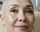 56 évesen méhnyakrákot diagnosztizáltak nálam – ez volt az első jele annak, hogy valami nincs rendben