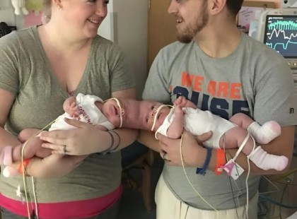 Szétválasztották őket – most így élnek: megrázó, amit a sziámi ikerlányok sorsa után látni fogsz! ?