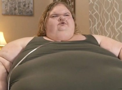 Sokkolta a rajongókat a valóságshow-sztár új, szinte felismerhetetlen külseje a nagy műtét után! Nézd meg, hogyan fest most!