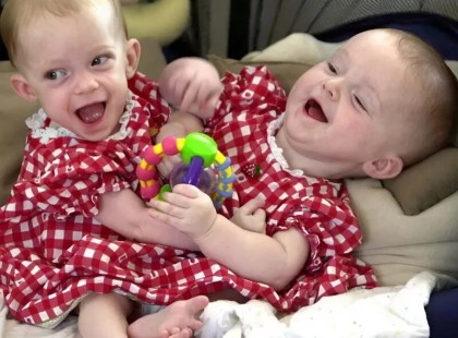 2000-ben született két kislány, akik a világ figyelmét azonnal magukra vonták. Sziámi ikrek voltak, testük a mellkastól egészen a medencéig összenőtt, belső szerveik közül pedig több közös volt ?.