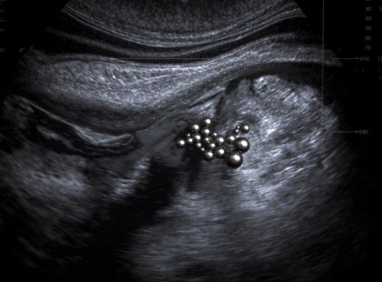 A szülők azt hitték, csupán rossz közérzet… Az ultrahang eredménye viszont lefagyasztotta a vért bennük