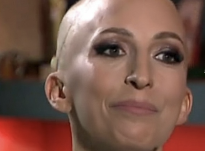 Rubint Réka a Tényekben vette le parókáját, sírva beszélt a betegségéről