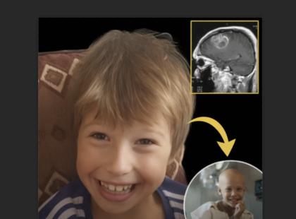 13 éves kisfiú az első aki túlélte a gyógyítatlannak hitt rákot – Teljesen felépült!