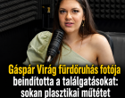 Gáspár Virág fürdőruhás fotója beindította a találgatásokat: sokan plasztikai műtétet sejtenek a háttérben