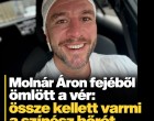 Molnár Áron fejéből ömlött a vér : össze kellett varrni a színész bőrét