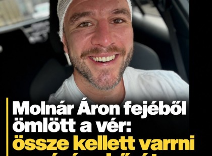Molnár Áron fejéből ömlött a vér : össze kellett varrni a színész bőrét