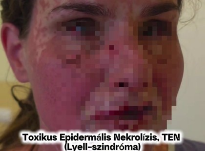 Szörnyen megrázó orvosi szakvélemény érkezett Agárdi Szilvi életveszélyes állapotáról!